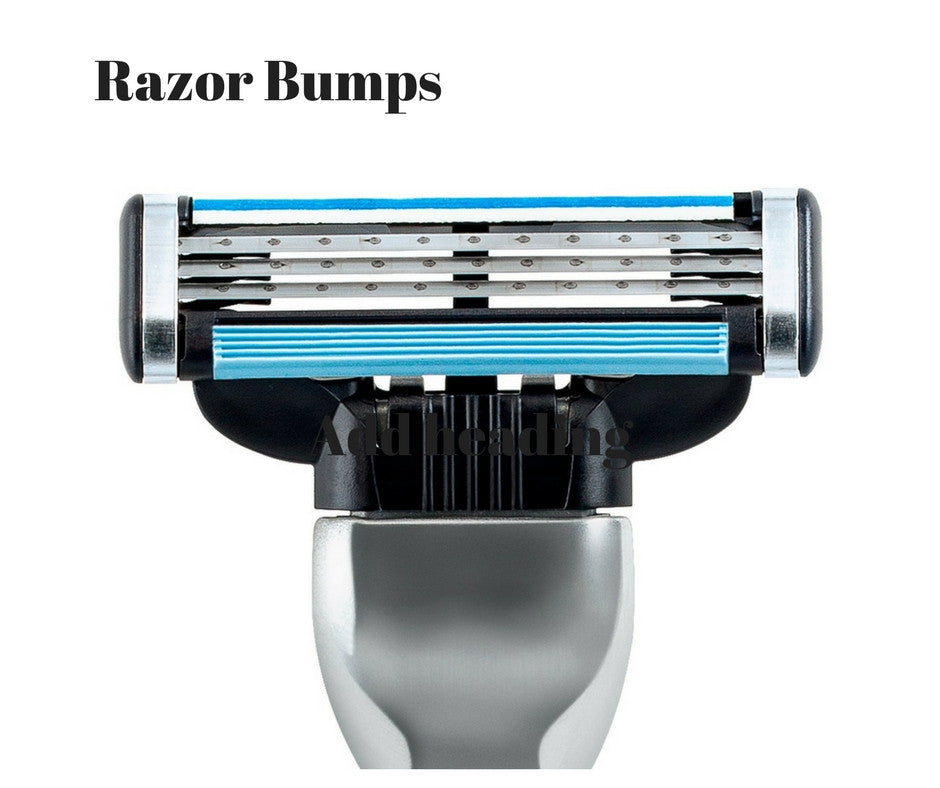 How to get rid of razor bumps